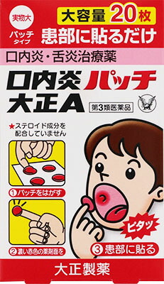 口内炎パッチ大正A 20パッチの商品画像